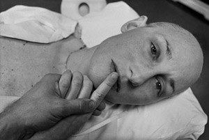 Eugene Richards's Final Treatment, Boston, Massacusetts (collection of the artist/ICP, 1979)